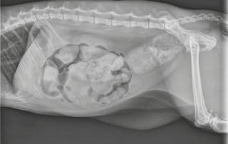 Radiografía abdominal lateral 